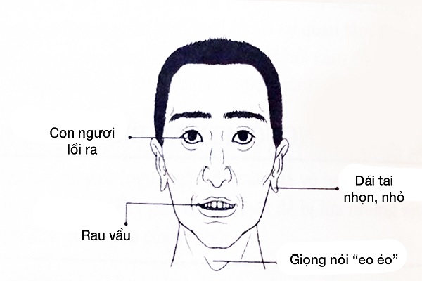 Xem tướng mặt đàn ông đoán tính cách, vận mệnh-9