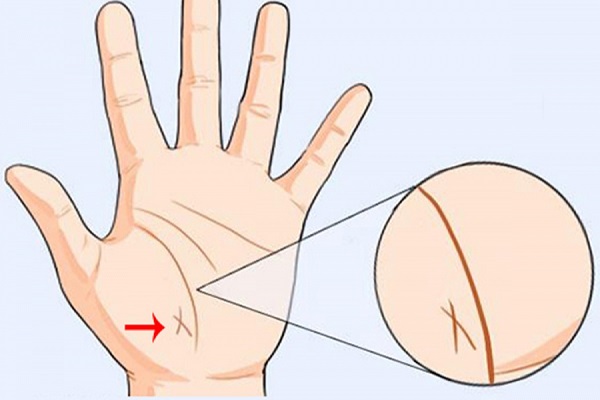 Chữ X trong lòng bàn tay nói lên điều gì? 4