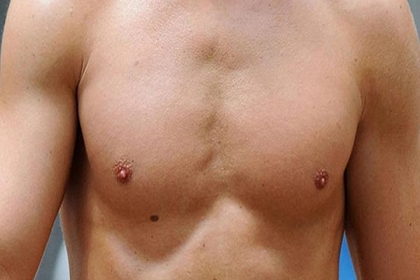 Nốt ruồi trên ngực đàn ông, phụ nữ nói lên điều gì?-3