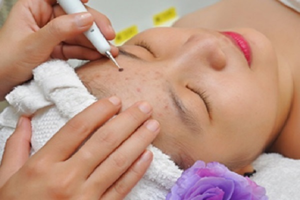 Nốt ruồi trên trán đàn ông, phụ nữ nói lên điều gì?-5 Nốt ruồi trên trán đàn ông, phụ nữ nói lên điều gì?-5