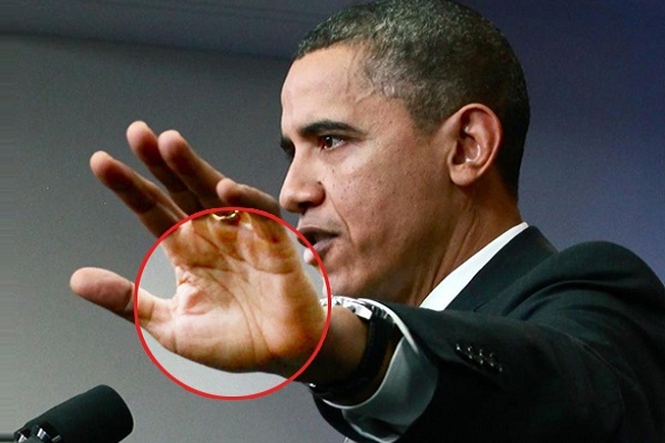 Đường sinh đạo đôi (song song) thì sao?-2