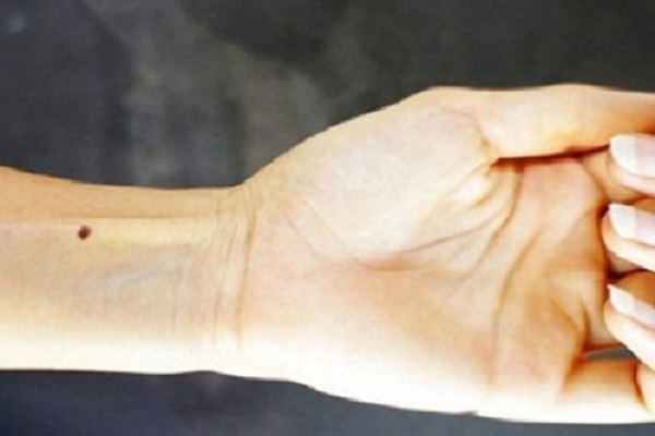 Nốt ruồi ở cổ tay trái - phải nam nữ ý nghĩa gì?-2