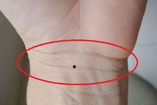 Nốt ruồi ở cổ tay trái - phải nam nữ ý nghĩa gì?-1