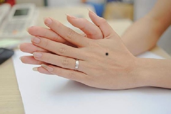 Nốt ruồi ở mu bàn tay trái - phải là hên hay xui?-2