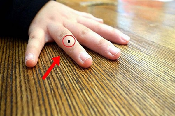 Nốt ruồi ở ngón tay út, cái, đeo nhẫn thì sao?-5