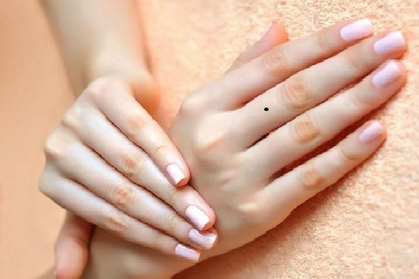 Nốt ruồi ở ngón tay út, cái, đeo nhẫn thì sao?-4