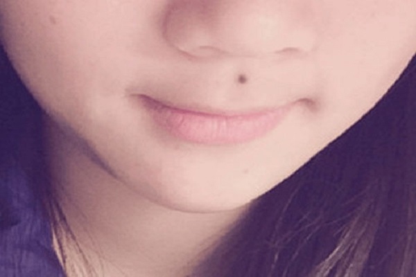 Nốt ruồi ở nhân trung nam – nữ có ý nghĩa gì?-3