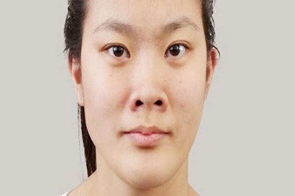 Mũi tẹt đẹp hay xấu? Xem tướng mũi tẹt đoán vận mệnh-3 Mũi tẹt đẹp hay xấu? Xem tướng mũi tẹt đoán vận mệnh-3