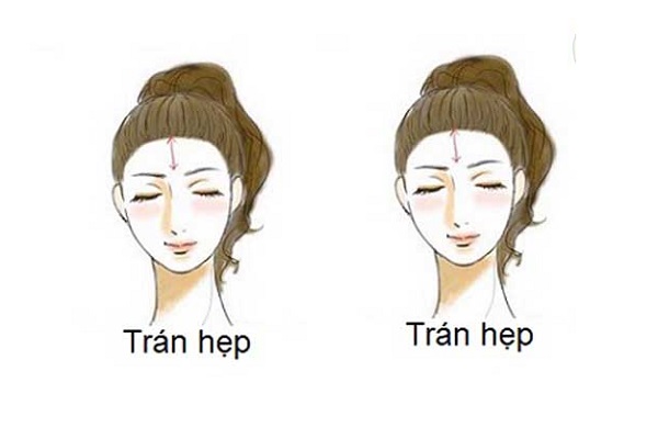 Tướng trán hẹp nam, nữ có ý nghĩa gì trong tướng số-1