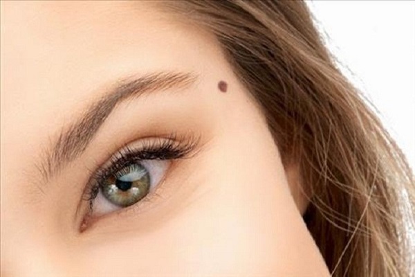 Nốt ruồi ở đầu – cuối lông mày nam nữ nói lên điều gì?-2